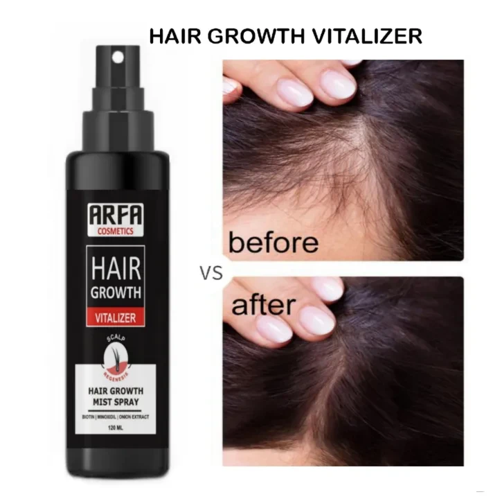 Arfa Cosmetics Minoxidil 5% Hair Growth Minoxidil Spray Hair Tonic For Hair Care Hair Loss and Hair Growth Premium