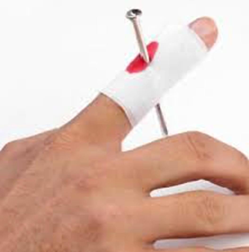 Nail through Finger Magic/Prank/Joke Illusion Tricks