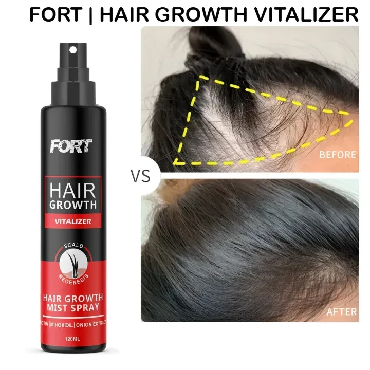 FORT Minoxidil Hair Growth Spray - Hair Tonic for Hair Care and Hair Growth - Premium Hair Care ProductWomen and Men all Hair Types